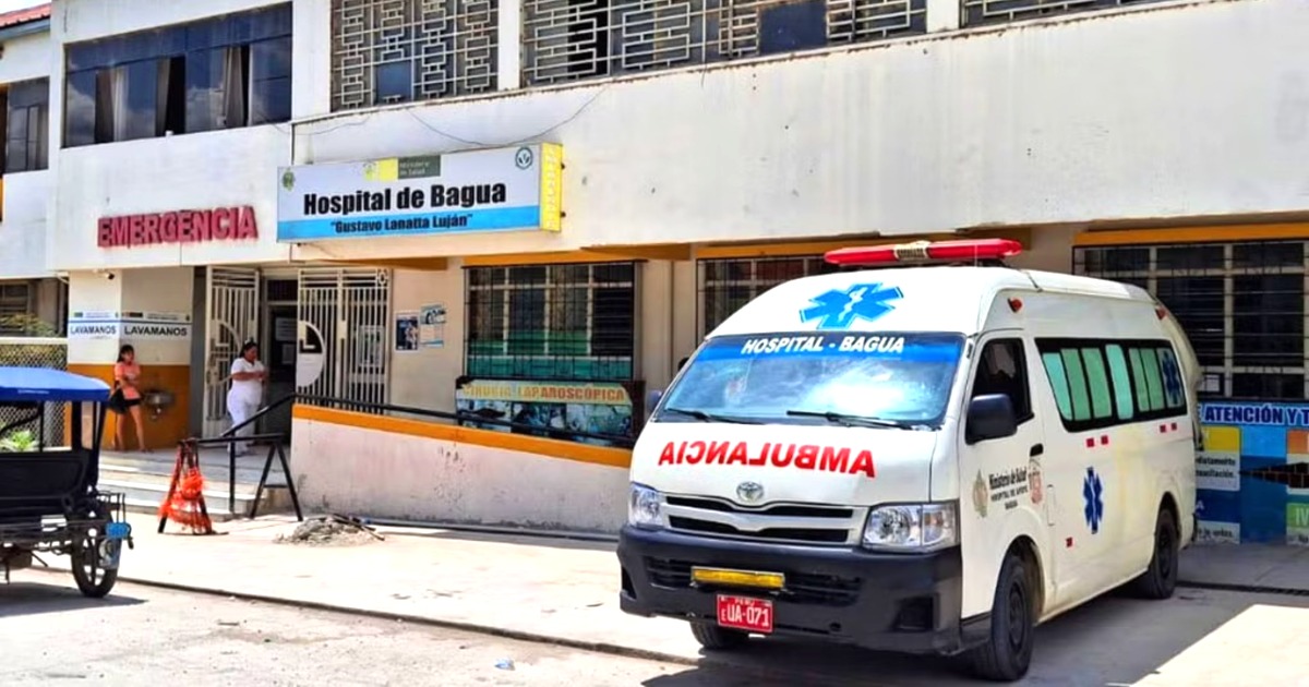Dos niños son hospitalizados por leptospirosis en Bagua